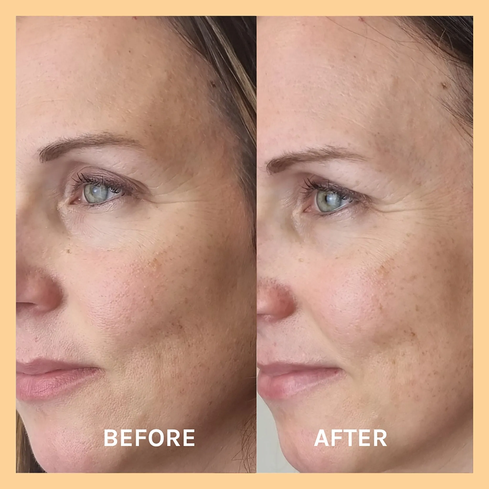 Miracle Vitamin C Mask
